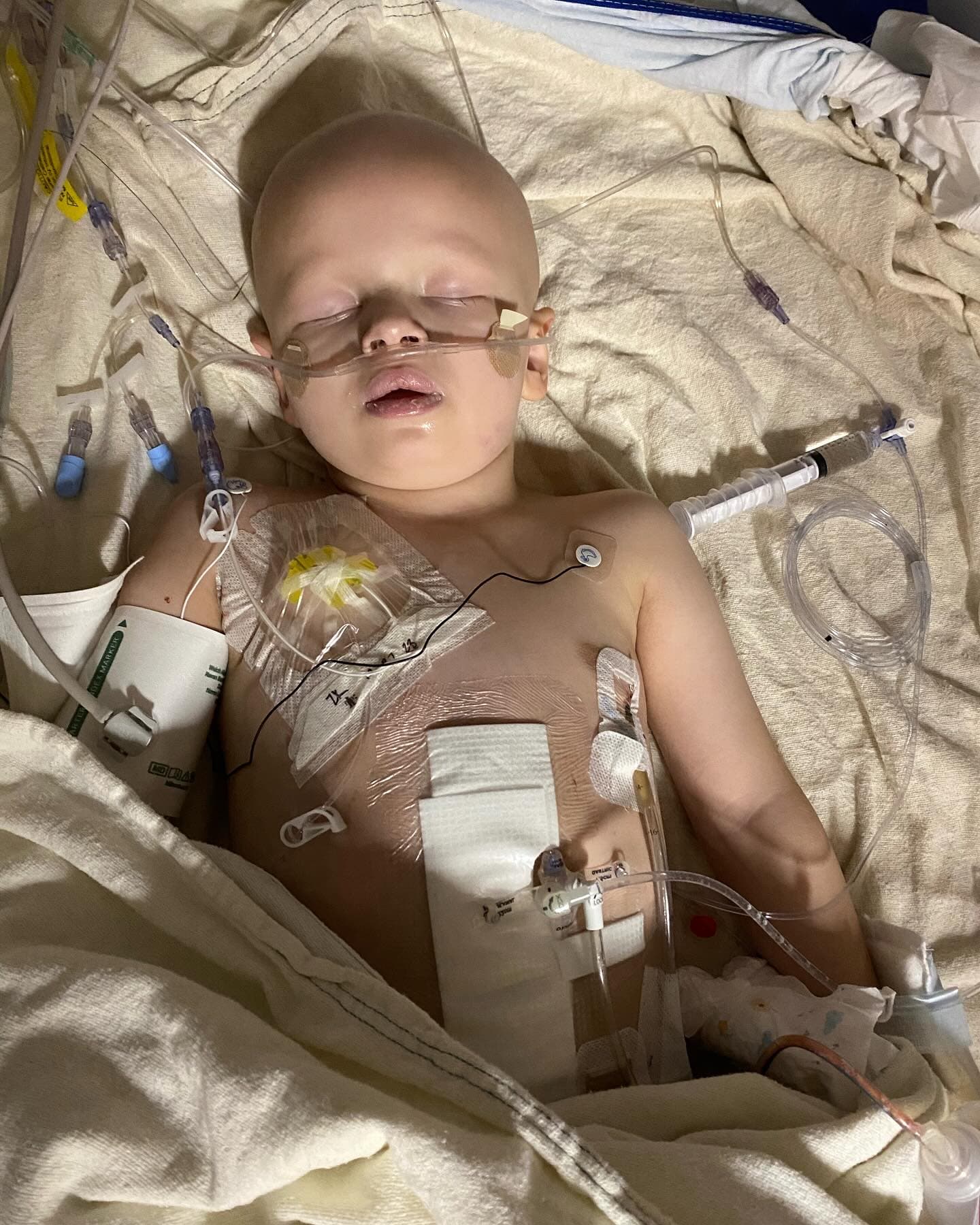 Help Little Isaac Fight Stage IV Neuroblastoma - Photo 1